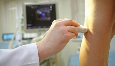 Tratamento con láser de varices